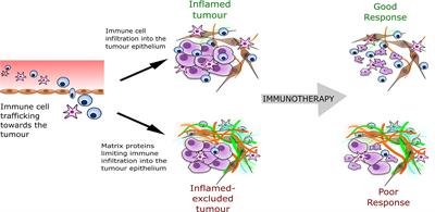 Targeting Versican as a Potential Immunotherapeutic Strategy in the Treatment of Cancer